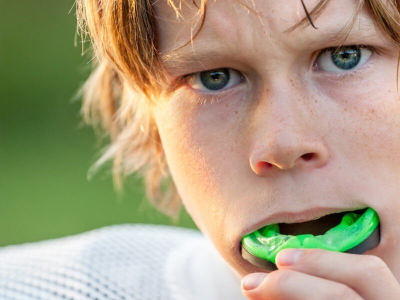 Custom Mouthguards