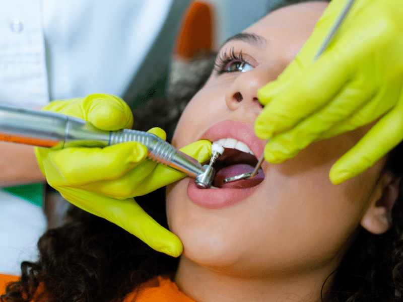 Teeth Whitening
