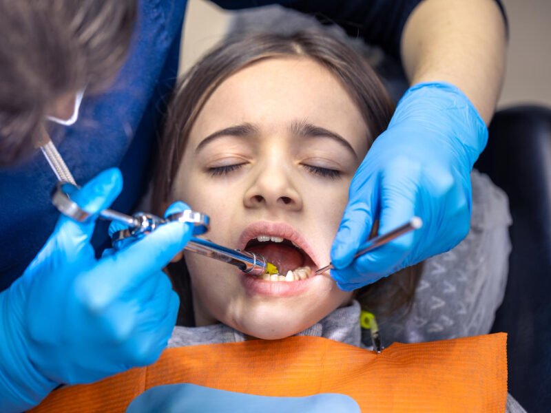 Fluoride Treatment for Kids: What Every Parent Should Know