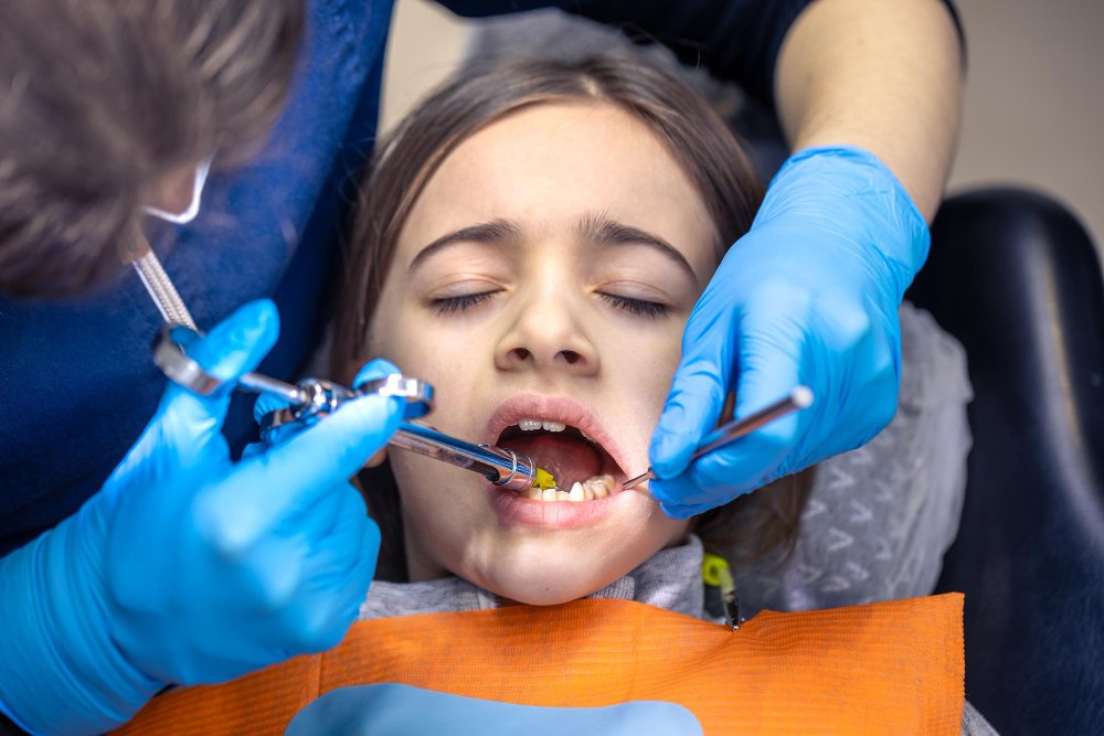 Fluoride Treatment for Kids: What Every Parent Should Know